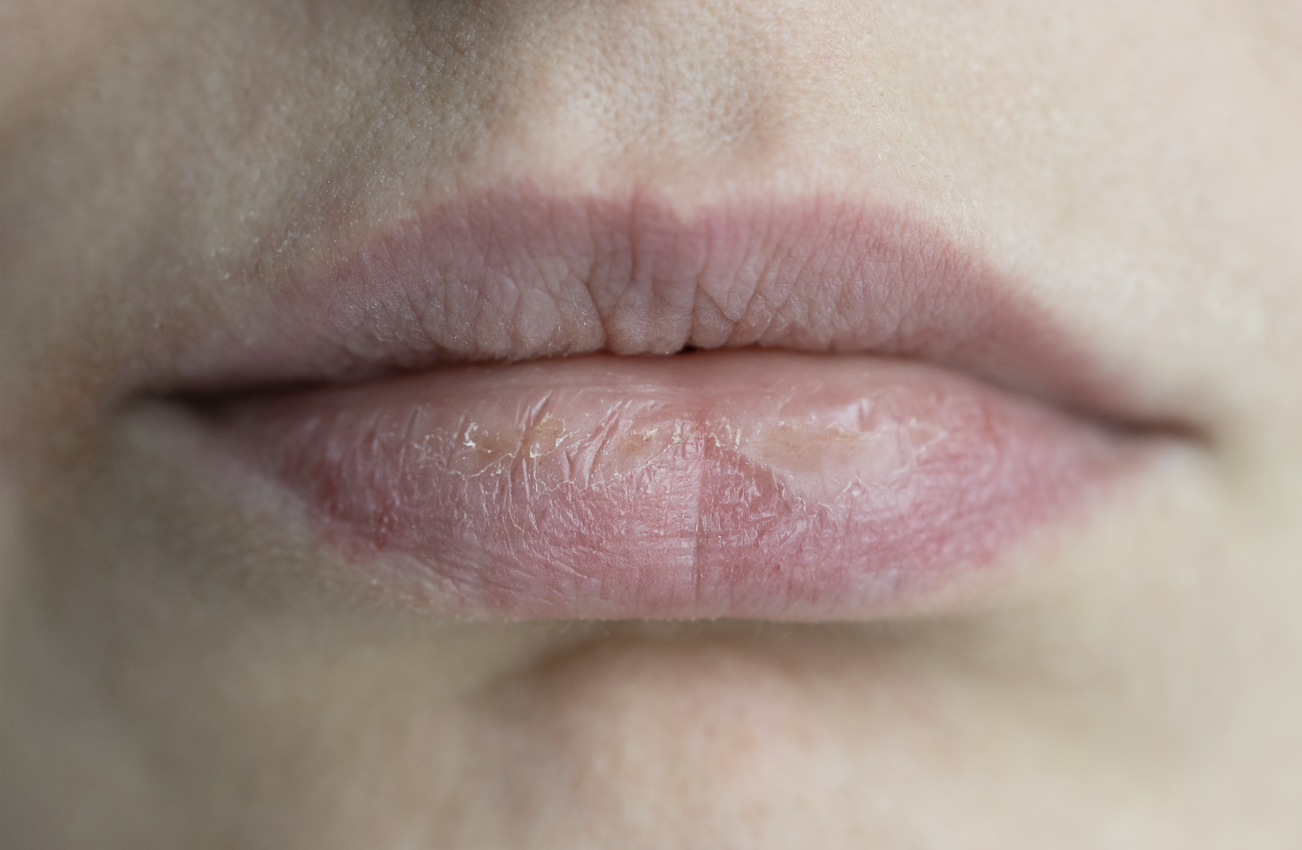 Tips for Smooth, Moisturized Lips